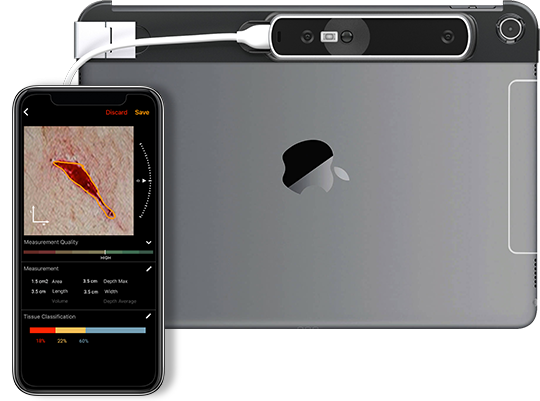 3D reconstruction of a wound