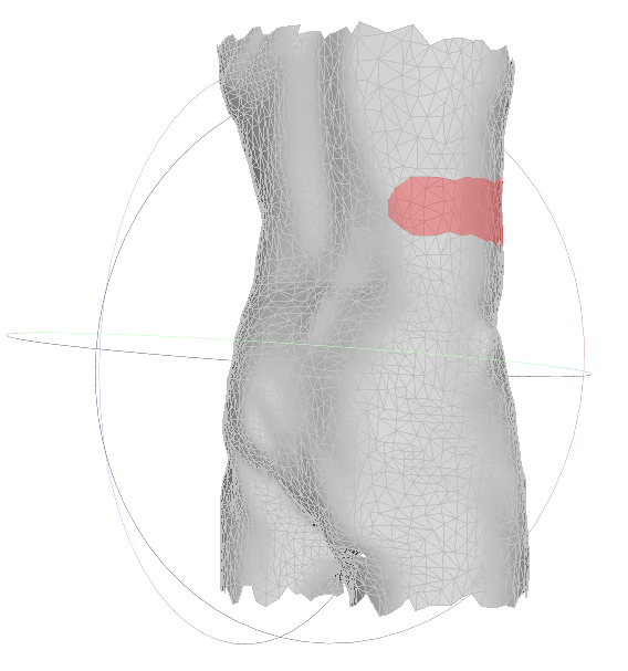 3D Circumferential Wound Scanning